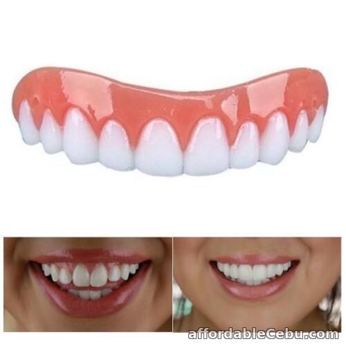 1st picture of Instant Smile Veneer #1 Solution For Perfect Smile For Sale in Cebu, Philippines