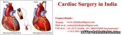 1st picture of Is Cardiac Surgery in India among the best in the world? Offer in Cebu, Philippines
