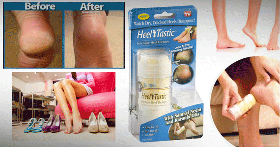 2nd picture of Heel Tastic Intensive Heel Therapy For Sale in Cebu, Philippines