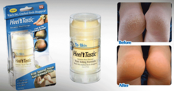 3rd picture of Heel Tastic Intensive Heel Therapy For Sale in Cebu, Philippines