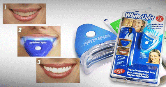 5th picture of Whitelight Teeth Whitening System For Sale in Cebu, Philippines