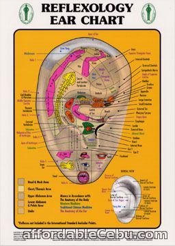 1st picture of Auricular Therapy (Ear Acupuncture) Announcement in Cebu, Philippines