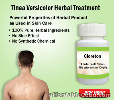 1st picture of Natural Treatment for Tinea Versicolor For Sale in Cebu, Philippines
