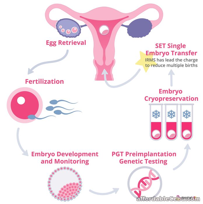 1st picture of IVF COST IN HYDERABAD Offer in Cebu, Philippines