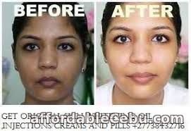 3rd picture of BEST SKIN WHITENING AND BLEACHING PRODUCTS CALL +27738432716 For Sale in Cebu, Philippines