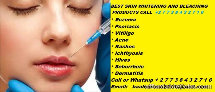 5th picture of BEST SKIN WHITENING AND BLEACHING PRODUCTS CALL +27738432716 For Sale in Cebu, Philippines
