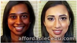 1st picture of BEST SKIN WHITENING AND BLEACHING PRODUCTS CALL +27738432716 For Sale in Cebu, Philippines
