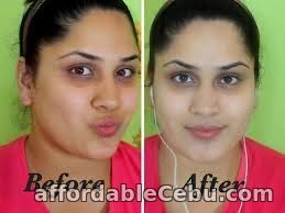 2nd picture of BEST SKIN WHITENING AND BLEACHING PRODUCTS CALL +27738432716 For Sale in Cebu, Philippines