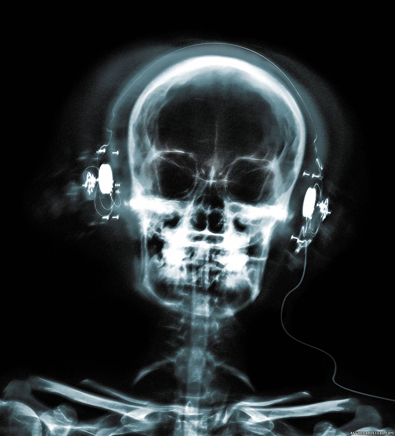 xray pictures xray pictures