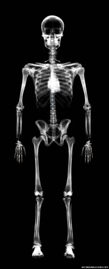 Picture of Incredible Human X-Ray Pictures