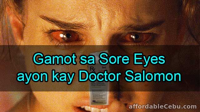 Gamot sa Sore Eyes ayon kay Doctor Karen Conol-Salomon