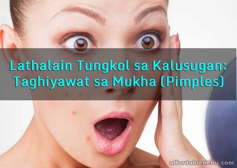 Feature Writing Lathalain Tungkol sa Kalusugan - Taghiyawat sa Mukha Pimples